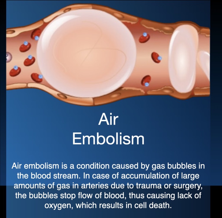 Air Embolism