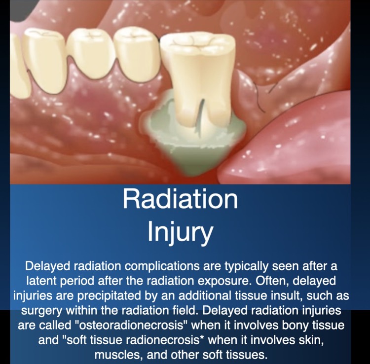 Radiation Injury