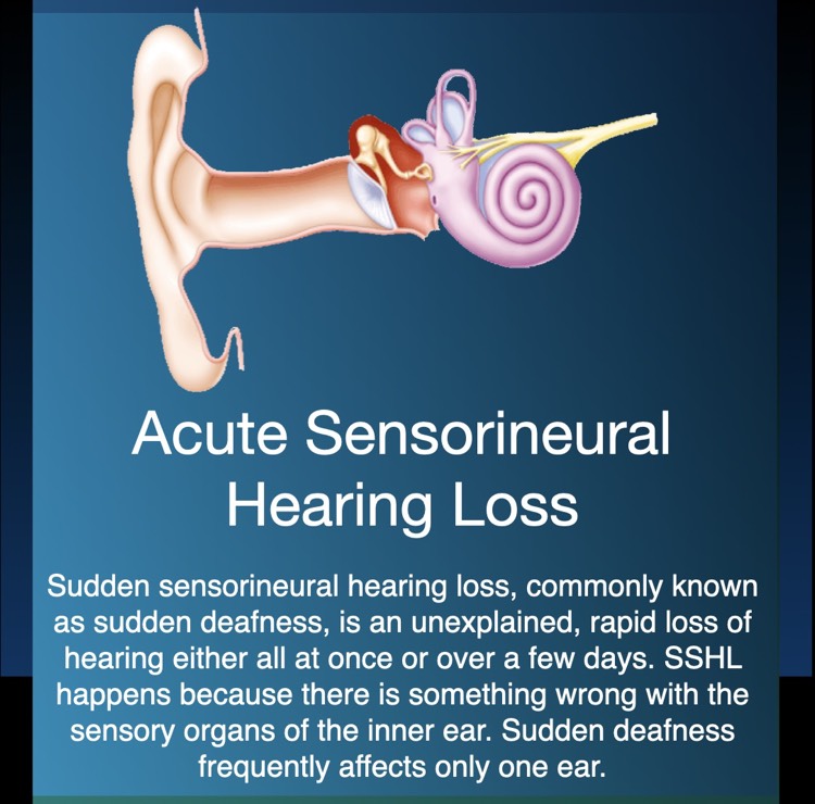 Acute Sensorineural Hearing Loss